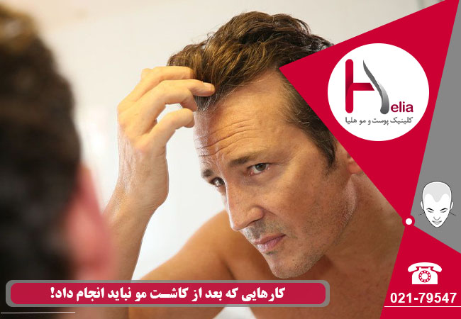 Things not to do after hair transplantation