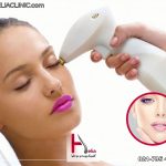 پاکسازی صورت با لیزر موهای زائد