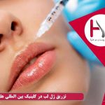 تزریق ژل لب در کلینیک بین المللی هلیا