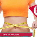 جراحی لیپوماتیک در زنان