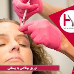 بوتاکس پیشانی