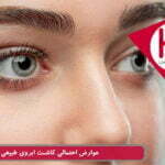 عوارض و خطرات احتمالی پیوند ابروی طبیعی