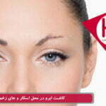 کاشت ابروی طبیعی در ناحیه اسکار و جای زخم