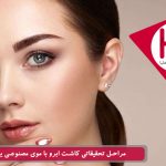 پیوند ابرو بیوفایبر