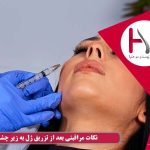 نکات مراقبتی بعد از تزریق ژل به زیر چشم