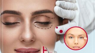 علت کوچک شدن چشم ها در اثر تزریق بوتاکس