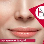 آیا تزریق ژل خط خنده درد دارد ؟