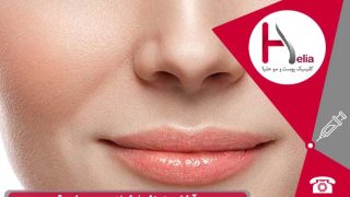 آیا تزریق ژل خط خنده درد دارد ؟