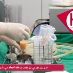 ترانسفر چربی چند مرحله دارد؟