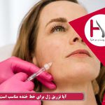 تزریق ژل برای خط خنده خوب است؟