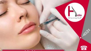 بهترین مارک ژل لب