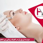 هزینه تزریق ژل در کلینیک هلیا