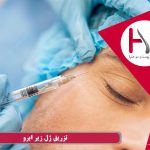 تزریق ژل زیر ابرو