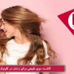 کاشت مو در زنان