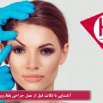 مراقبت های قبل از جراحی پلک