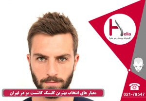 معیار های انتخاب بهترین مرکز کاشت مو در تهران