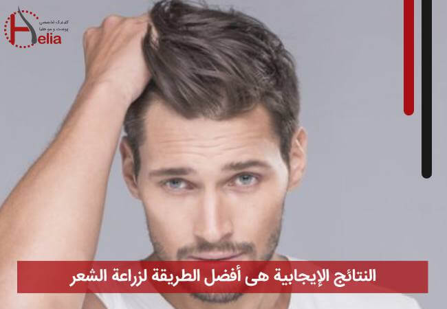 النتائج الإیجابیة هی أفضل الطریقة لزراعة الشعر