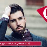 15 نکته مراقبتی بعد از پیوند موی طبیعی