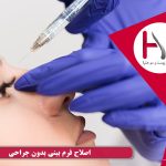 اصلاح فرم بینی بدون عمل جراحی
