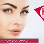 درمان قطعی زخم های بعد از کاشت ابرو