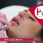 مدل های تزریق ژل به لب