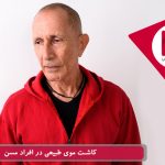 پیوند موی طبیعی در افراد مسن