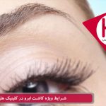 شرایط ویژه کاشت ابرو در کلینیک هلیا