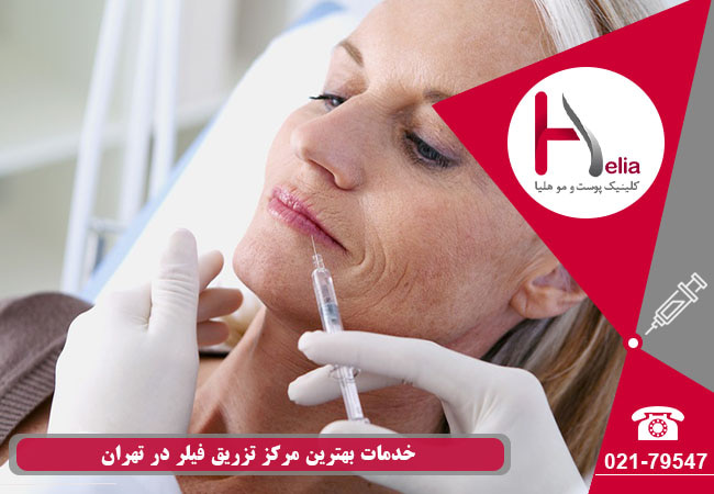 خدمات بهترین کلینیک تزریق ژل در تهران