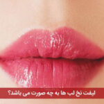 لیفت نخ لب ها به چه صورت می باشد