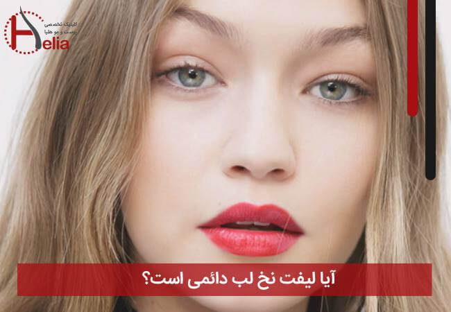 آیا لیفت نخ لب دائمی است؟