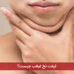 لیفت نخ غبغب چیست