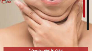لیفت نخ غبغب چیست