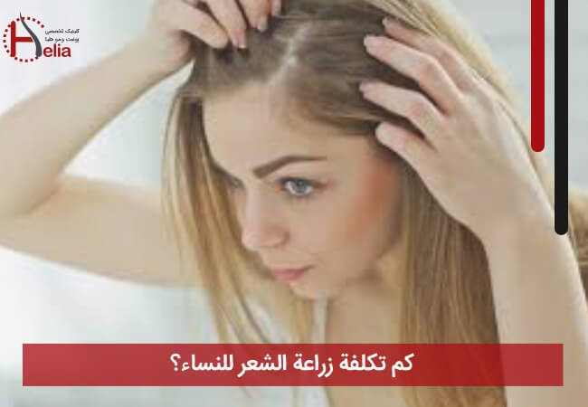 کم تکلفة زراعة الشعر للنساء