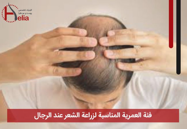 فئة العمریة المناسبة راعة الشعر عند الرجال