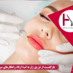 بازگشت از تزریق ژل به لب