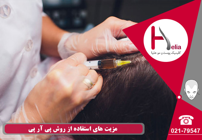 مزیت های استفاده از روش PRP برای درمان ریزش مو چیست؟
