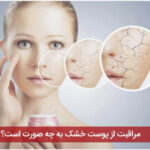 مراقبت از پوست خشک به چه صورت است؟
