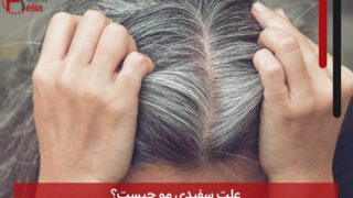 علت سفیدی مو چیست؟