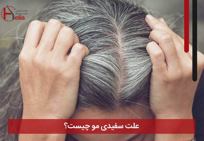 علت سفیدی مو چیست؟
