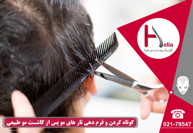 کوتاه کردن و فرم دهی تار های مو پس از کاشت مو طبیعی