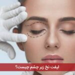 لیفت نخ زیر چشم چیست