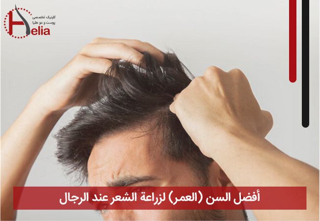 أفضل السن (العمر) لزراعة الشعر عند الرجال