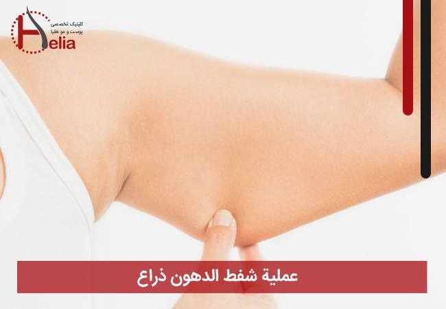 عملیة شفط الدهون ذراع