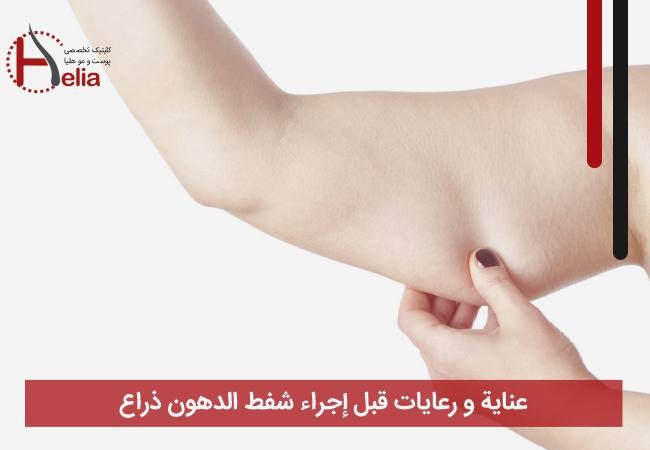 عنایة و رعایات قبل إجراء شفط الدهون ذراع