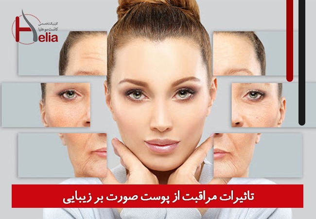 تاثیرات مراقبت از پوست صورت بر زیبایی