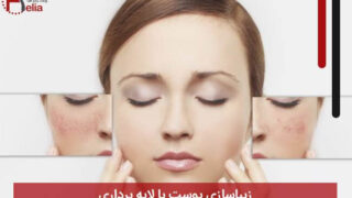 زیباسازی پوست با لایه برداری