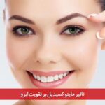 تاثیر ماینوکسیدیل بر تقویت ابرو