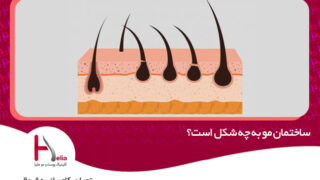ساختمان مو به چه شکل است؟