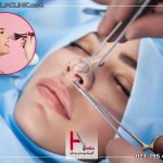 تا چه مدت بعد از جراحی بینی آرایش نباید کرد