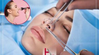 تا چه مدت بعد از جراحی بینی آرایش نباید کرد